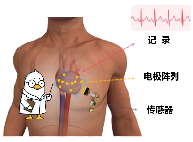 心电监测系统的科技创新